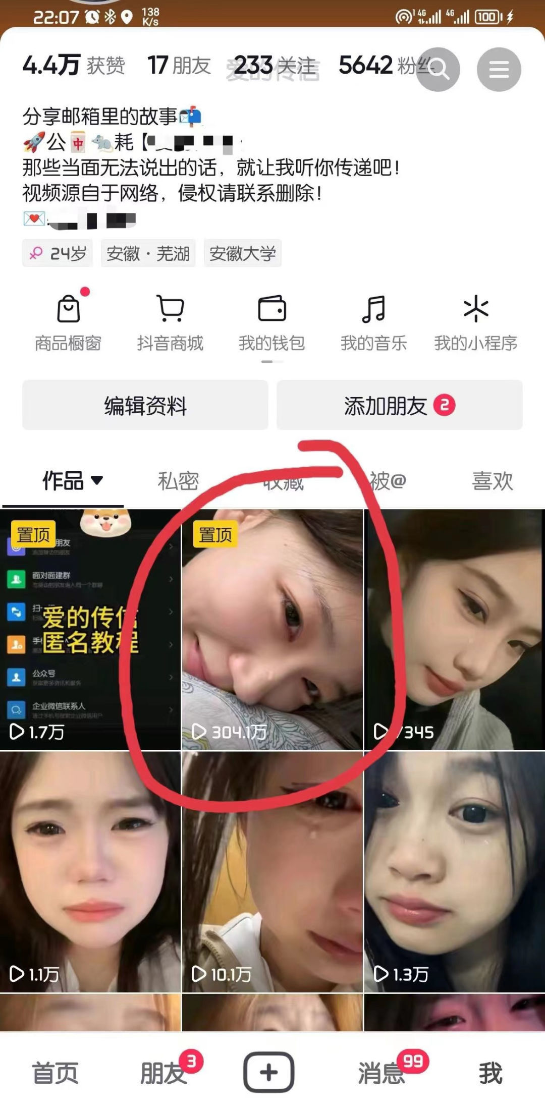 抖音账号案例